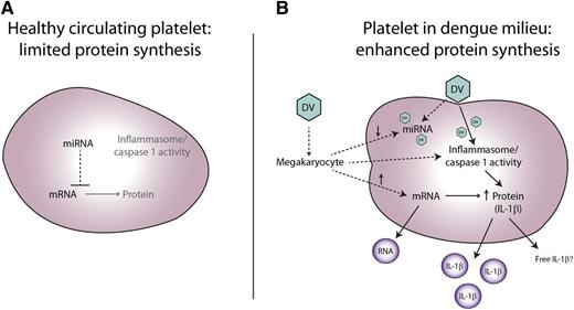 Model of dengue-mediated platelet IL-1β synthesis and release. (A) Model proposes that platelets in healthy state have relatively modest levels of the components of the inflammasome and caspase 1 activity, and limited messenger RNA (mRNA) translation into protein. The low level of translation may be due to microRNA (miRNA) inhibition of translation and/or low mRNA levels. (B) DV induces in vivo platelet translation of mRNA into IL-1β. DV mediates inflammasome-mediated caspase 1 activation, enabling processing into active IL-1β with subsequent release into MVs for systemic transport. Activated platelets also release RNA in vesicles. Because DV replication involves silencing host miRNA production, megakaryocytes may deliver less miRNA for inhibiting platelet mRNA translation, or DV could compete with endogenous miRNAs. In addition, DV may induce increased megakaryocyte delivery of IL-1β mRNA to the platelet. Dashed lines indicate the uncertainty of the early events in the model.