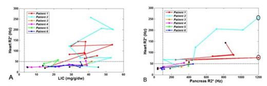 Figure 1. (A) Time course of heart R2* versus LIC. (B) Heart R2* versus pancreas R2*.