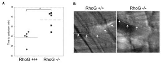 Figure 3. (A): Time required for occlusion of cremaster arterioles in RhoG +/+ and RhoG -/- mice was measured using microvascular thrombosis model with light/dye-induced injury. 5 mice of each genotype were used, and statistical analysis revealed a significant difference between the 2 genotypes of mice (*, P < .01). (B) Representative images of cremaster arterioles were taken from RhoG +/+ and RhoG -/- mice 30 min after the injury. As seen with the outline (arrows) of the thrombus formed, thrombus formation was inhibited in RhoG -/- mice.