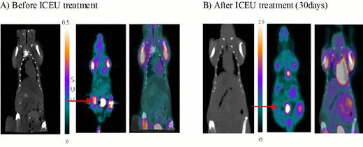 Figure. 2. Micro-PET image of AML mass in mouse model. Xenografted AML cells as subcutaneous mass formation was noted in right thigh area (A) before treatment of PHB inhibitor. AML mass in mouse model was completely disappeared after treatment of PHB inhibitor for 30 days (B).