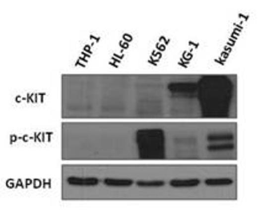 Figure 1. c-KIT and phosphorylated c-KIT expression in myeloid leukemia cell lines