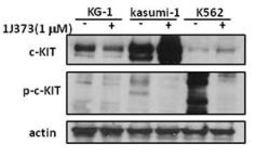 Figure 1. c-KIT and phosphorylated c-KIT expression in myeloid leukemia cell lines