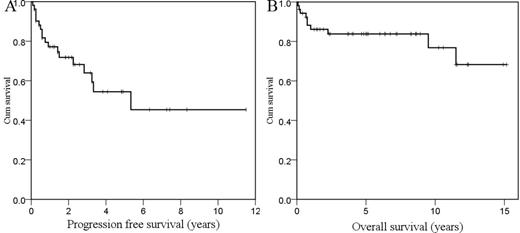 Figure 1. Progression free survival (A) and overall survival (B) of 53 patients with PB-DLBCL