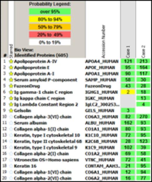 Figure 2. Enfuvirtide (Fuzeon¨)-associated amyloidosis