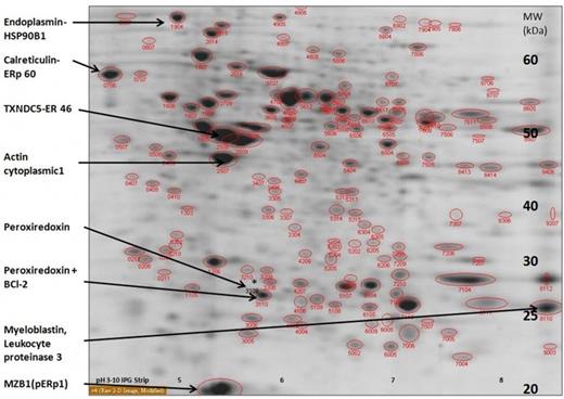Figure 1. 2D gel image of identified proteins.
