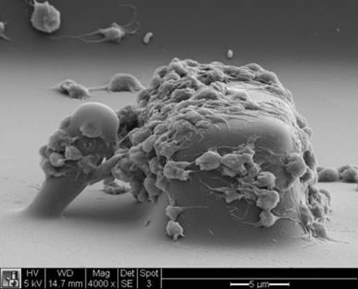 Figure 1. Platelet forces are measured using blocks and posts in a microfluidic device. As platelets in blood passes around the block, they experience a high shear rate that causes their adhesion, aggregation, and generation of force that bends the post towards the block.