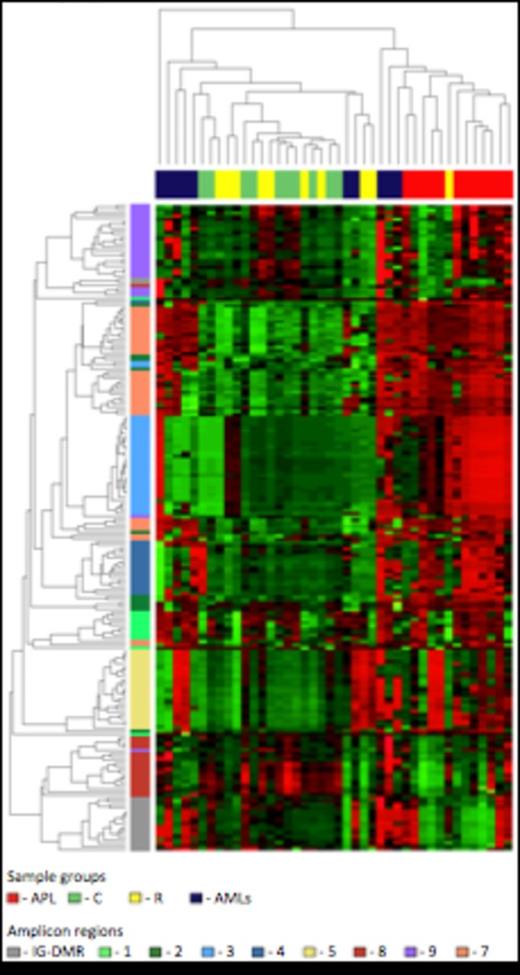 Figure 1. Unsupervised hierarchical cluster analysis of the CpG methylation levels. Each row represents a CpG site and each column a sample. The percentage of CpG methylation is depicted using color scales of red (CpG methylation > 50%) and green (CpG methylation < 50%). Sample group labels are indicated (APL; Control; Remission; AMLs).
