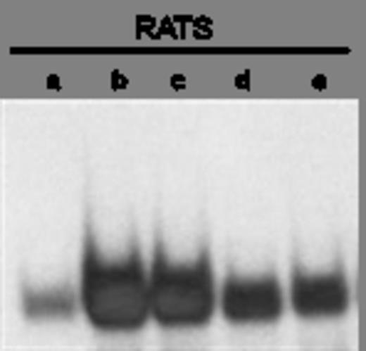 Figure 2. EMSA with Ets-2 protein eluted from cord blood-derived naive T-cells and an oligonucleotide probe mapping the RATS sequence. a-e represent points with decreasing amounts of protein eluates.