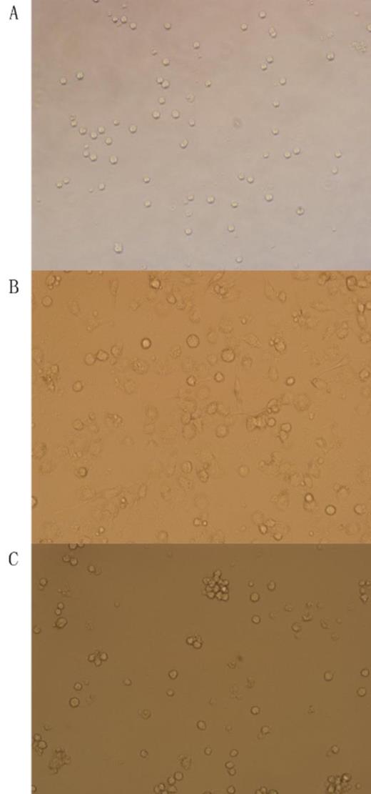 Figure 1. The morphology of THP-1 cell lines in different polarization (200X). A. undifferentiated monocytes (Group A); B. M1 type macrophages (Group B) there were pseudopodia and phagocytosed particles in macrophages; C. M2 type macrophages (Group C).