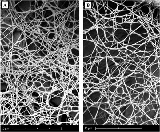 Figure 1. Representative fibrin clot for adults (A) and infants (B).