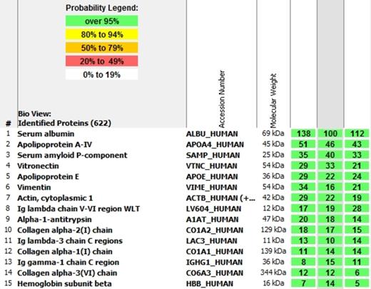 Figure 2. Spectroscopic Analysis of the proteins extracted from the patient's lymph node, showing the presence of immunoglobulin lambda light chain (numbers 8 and 11).