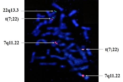 Figure 1. Fusion signal of t(7;22) on passage 5