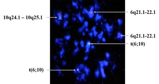 Figure 2. Fusion signal of t(6;10) on passage 6