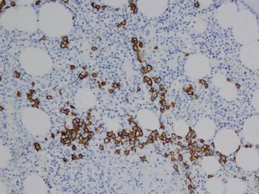 Figure 2. CD138+ PCs