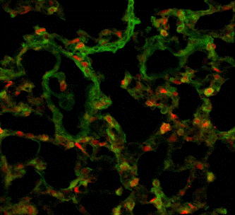 Figure 1. The donor and recipient cells' morphous, location, ratio and cellular interaction can be visually observed in recipient mice's lung under confocal microscope (250x).
