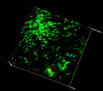 Figure 2. By semi-solid decalcification and three-dimensional reconstruction under confocal microscopy, the relationships of GFP and RFP marked cells in the bone marrow microenvironment are clearly demonstrated, with their original position, fluorescence and morphous. Several RFP donor's cells were found surrounded by the GFP recipient's cells, both cells cross-talking actively (200x).