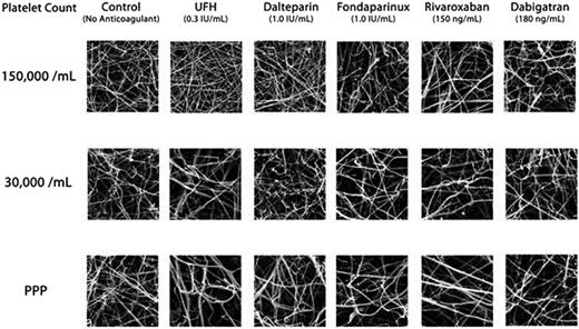 Figure 1. SEM images of plasma clot formed with varying levels of platelets in the absence or presence of anticoagulants.