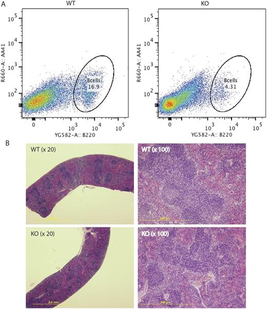 Figure 2. B cell development in spleen.