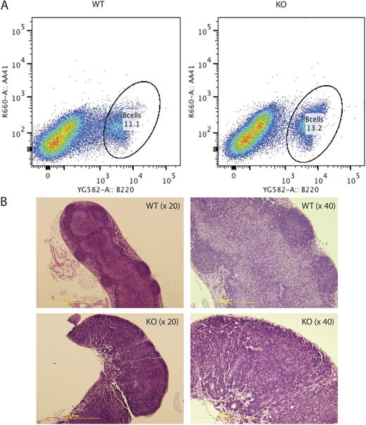 Figure 3. B cell development in lymph nodes.