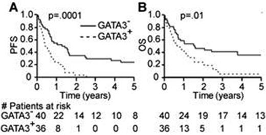 Figure 1. GATA-3 expression identifies a subset of PTCL, NOS with inferior survival. Kaplan-Meier estimates of progression-free and overall survival are shown for PTCL, NOS patients stratified by GATA-3 expression. (GATA3-, solid line; GATA3+, dashed line) A.PFS: progression-free survival; B. OS: Overall survival