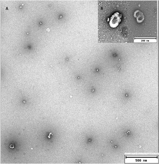 Figure 1. MVs from MSC -MDS analysed by TEM. A. Scale bar 500nm. B. Scale bar 200nm