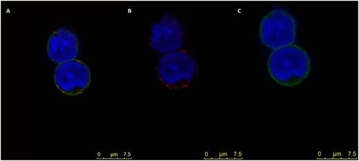 Figure 2. CM images A- C Sequential images of CD34+ cells with MVs from MSC-MDS. A. overlay (CD90 in red and CD45 in green), B CD34+ with anti CD 90 (red) and C with anti-CD45 (green). DAPI (blue)