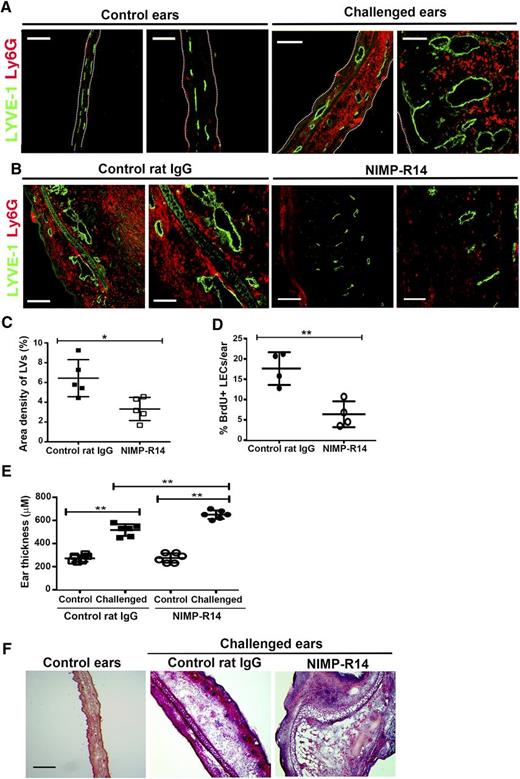 Figure 3. Attenuating neutrophil accumulation inhibits lymphangiogenesis in chronic CHS. (A) Ear sections were immunostained for Ly6G and LYVE-1 to examine neutrophil infiltration and lymphatic vessels after DNCB sensitization. (B) Neutrophil accumulation and lymphatic vessels in DNCB-challenged ears from NIMP-R14- and control rat IgG-treated mice. (C) Density of lymphatic vessels in DNCB-challenged ears from NIMP-R14- and control rat IgG-treated mice. (D) Percentage of BrdU+ proliferating LECs in DNCB-challenged ears of mice that received NIMP-R14 or control rat IgG treatment. (E) Ear thickness of DNCB-challenged ears from NIMP-R14- and control rat IgG-treated mice. (F) Hematoxylin and eosin staining of control or challenged ears from NIMP-R14- and control rat IgG-treated mice. Data from panel D consist of 4 mice per group (n = 4). All other data shown are representative or pooled from 2 independent experiments with 3 mice per group in each experiment (n = 6). *P < .05; **P < .01. Bars represent mean ± SD. Images are representative of 3 independent experiments (n = 3) for panel A and 5 independent experiments (n = 5) for panels B and F. Scale bars in the right and left panels of panel A represent 100 and 75 μm, respectively. Scale bars in the right and left panels of panel B represent 75 and 50 μm, respectively. Scale bar in panel F represents 2 mm. Dotted lines denote boundary of ear sections.