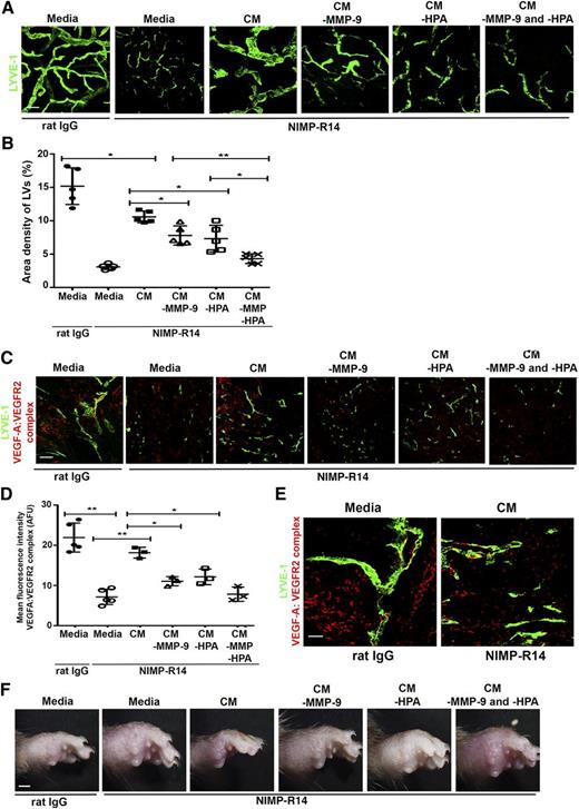 Figure 7. Neutrophil-derived MMP-9 and heparanase modulate VEGF-A bioavailability and bioactivity to promote lymphangiogenesis. (A) Footpad skin whole mounts were examined for lymphatic vessels at 14 days postimmunization after administration of complete or treated CM into immunized, NIMP-R14-treated mice. (B) Lymphatic vessel density in footpad skin whole mounts after administration of complete or treated CM into immunized, NIMP-R14-treated mice. (C) Footpad sections were immunostained for VEGFA:VEGFR2 complexes in footpads. (D) Mean fluorescence intensity of VEGF-A:VEGFR2 complexes in footpads from immunized, NIMP-R14-treated mice receiving complete or treated CM. (E) Footpad sections were examined at higher magnification for localization of VEGF-A:VEGFR2 complexes with lymphatic vessels. (F) Footpad swelling after administration of complete or treated CM into immunized, NIMP-R14-treated mice. Images from panels A, C, and F are representative of 5 mice per treatment group (n = 5). Scale bar in panels A and F represent 75 μm and 2 mm, respectively. Scale bars in panels C and E represent 75 and 50 μm, respectively. Data from panels B and D are pooled from 5 mice per treatment group (n = 5), and bars represent mean ± SD. *P < .05; **P < .01.