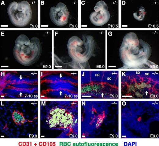 Figure 1. Rasip1 knockout mice die in midgestation with vascular defects. Brightfield images of mouse embryos (A-G) with the indicated ages and Rasip1 genotypes, showing pericardial edema and multifocal hemorrhage in Rasip1−/− embryos at E9.5 and E10.5; Rasip1−/− embryos were also significantly smaller than control at E10.5. Immunofluorescence staining of CD31 plus CD105 (red) and DAPI (blue) in whole-mount embryos (H-K) or transverse sections of DA (L-O) with the indicated ages and genotypes revealed irregular DA in Rasip −/− embryos. RBC autofluorescence (green) in panels J-O showed that erythrocytes were present in dilated vessels or in extravascular space in Rasip −/− embryos. Arrows indicate DA. DAPI, 4,6 diamidino-2-phenylindole; so, somite; ss, somite stage. Panels H-I, ventral view, rostral to the left; panels J-K, lateral view. Scale bars: (A-B,E-G) 0.5 mm; (C-D) 1 mm; (H-I) 50 μm; (J-K) 100 μm; (L-O) 10 μm.