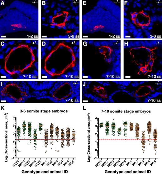 Figure 2. Rasip1 −/− mice form vascular lumen with evidence of localized collapse. Transverse sections of DAs from Rasip1+/− (A-D,I) and Rasip1−/− (E-H,J) embryos at the indicated somite stage were stained with CD31+CD105 (red) and DAPI (blue). Note that panels C-D,G-H are from adjacent sections, indicating localized collapse of the aorta in Rasip1−/− embryos. In panel J, note that the left DA collapsed, whereas the right DA was inflated. Scatter plots of DA lumenal areas from serial sections from Rasip1+/− (HET) and Rasip1−/− (KO) embryos at 3 to 6 ss (K) and 7 to 10 ss (L). The 20-μm2 cutoff line (red) indicates functional blood vessel (or DA) area. Rasip1−/− DAs display a wider variation of lumenal areas. Each point represents an individual area measurement of a DA section. Scale bars: (A,E) 20 μm; (B-D,F-H) 10 μm; (I-J) 25 μm.