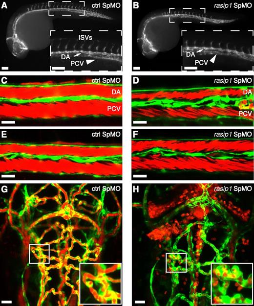 Figure 3. Knockdown of rasip1 in zebrafish affects vascular integrity. (A-B) Tg(kdrl:EGFP)s843 zebrafish embryos at 26 hpf were injected with control (ctrl) morpholino (MO) (A) or rasip1 MO (B). Arrows indicate dorsal aorta. Arrowheads indicate PCV. Insets show magnification of trunks. Note stalling of intersomitic vessels (ISVs). (C-F) Confocal projections of trunk axial vessels from control (C,E) or rasip1 (D,F) MO-injected Tg(kdrl:EGFP)s843;Tg(gata1:DsRED)sd2 double transgenic live embryos at 48 hpf. Images are maximum projections of 3 confocal slices. Note irregular appearance of the rasip1 KD DA and PCV (green) (D,F), which have patent lumen and contain circulating RBCs (red). (G-H) Maximum projections of head vasculature in ctrl (G) and rasip1 (H) MO-injected double transgenic fish at 48 hpf. Intralumenal RBCs were observed in both embryos (insets), whereas extravascular RBCs were only seen in the rasip1 KD embryo. The streaking appearance of red signal in panels C-F is due to rapid movement of RBCs. Scale bars: (A-B) 100 μm; (C-H) 20 μm.