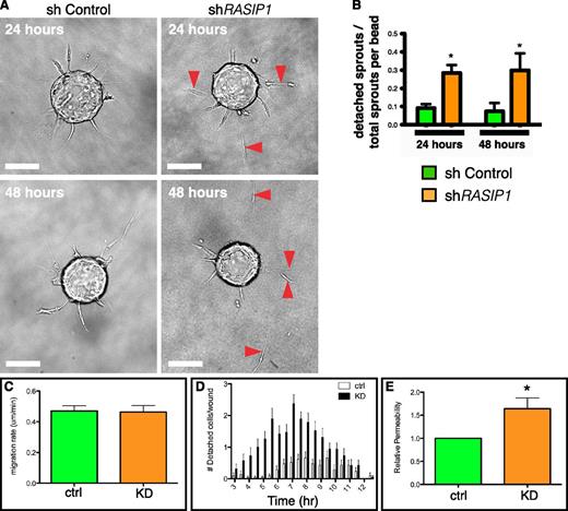 Figure 4. Knockdown of RASIP1 affects EC-EC attachment. (A) Differential interference contrast images of control and RASIP1 shRNA-treated HUVECs in an angiogenic sprouting assay, 24 and 48 hours after seeding. Most sprouts have moved into the fibrin matrix yet remain attached to ECs on the bead in the control group (left), whereas a subset of sprouts detached from the beads in the RASIP1 knockdown group (arrowheads, right). Scale bars, 100 μm. (B) Quantification of detached sprouts in 3 angiogenic sprouting experiments 24 and 48 hours postseeding. Twenty beads were counted per experiment. Error bars are interexperimental SEM. *P < .002 (2-way ANOVA). (C) Quantification of HUVEC migration rate (control and RASIP1 shRNA) in a scratch wound assay. (D) Quantification of the number of detached HUVECs from the leading edge in the scratch assay; 21 to 23 movies were scored per condition. (E) Relative measurement of 40-kDa FITC-dextran fluorescent signal passed across a control or RASIP1 shRNA-treated HUVEC monolayer. *P < .05 (Student t test). Error bars indicate SD for panels C-E.