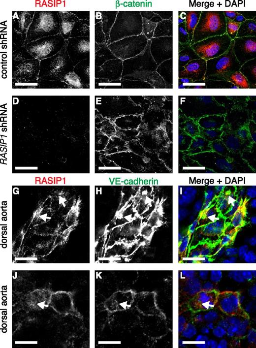 Figure 5. RASIP1 localizes to points of EC-EC contact. (A-F) Immunofluorescence staining of RASIP1 (red) in control (A-C) and RASIP1 shRNA (D-F) infected HUVECs treated with EGTA and cBiMPs, and permeabilized prior to fixation. Peripheral RASIP1 localized to the vicinity of β-catenin+ structures. (G-L) Whole-mount (G-I) or section (J-L) immunofluorescence of DA ECs from ∼E8.5 mouse embryos stained with RASIP1 (G,J, red in I,L) and VE-cadherin (H,K, green in I,L) antibodies. RASIP1 staining is often found at the cell periphery, close to VE-cadherin+ structures. Arrows indicate intracellular VE-cadherin and RASIP1 staining. Scale bars: (A-F) 20 μm; (G-L) 30 μm; (J-L) 10 μm.