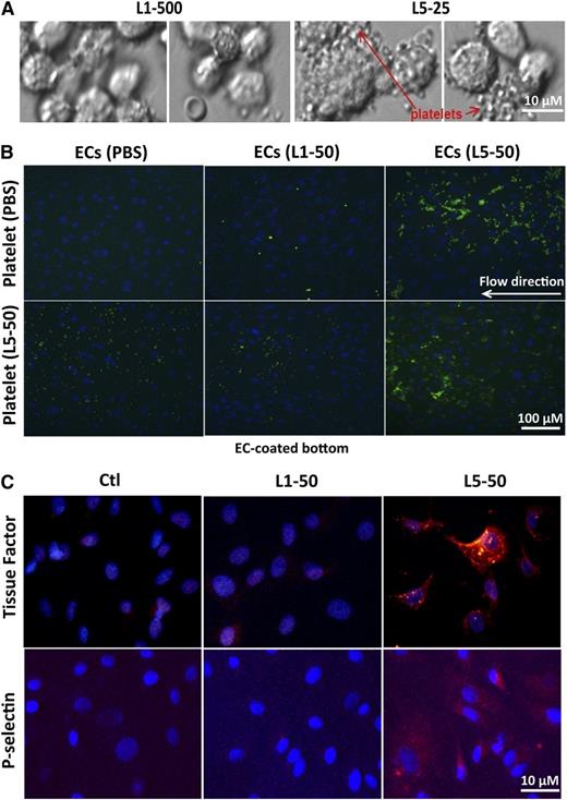 Figure 6. L5-mediated EC dysfunction. (A) HAECs were cultured in the presence of vehicle (endothelial growth media), L1 (500 μg/mL), or L5 (25 μg/mL) for 24 hours. Cells were then incubated with freshly collected whole blood from control subjects for 15 minutes, followed by 5 washes with PBS. Platelets were attached and aggregated on L5-treated HAECs but not L1-treated HAECs. Olympus BX51; bar = 10 µm. (B) Results of parallel plate flow chamber analysis with BAECs are shown. Cells were stained with 1 µM Hoechst (blue) to visualize cell nuclei. Human PRP samples containing 1 part acid sodium citrate (an anticoagulant), 10 µM calcein AM (makes platelets green), and unstimulated (treated with PBS) or L5-stimulated platelets were perfused at a flow rate of 750 S−1, and platelet-EC interactions were analyzed by fluorescence microscopy. (B, upper) Unstimulated (PBS-treated) platelets were attached to L5-treated BAECs. (B, lower) L5-stimulated platelets were slightly attached to PBS- or L1-treated BAECs but attached to L5-treated BAECs. Olympus IX70; bar = 100 µm. (C) Immunofluorescence staining with Alexa Fluor 555 (red) shows the expression of (upper) tissue factor and (lower) P-selectin in BAECs treated with PBS (Ctl), 50 μg/mL L1, or 50 μg/mL L5 for 24 hours. Cell nuclei were stained with DAPI (n = 3). Olympus IX70; bar = 10 µm.
