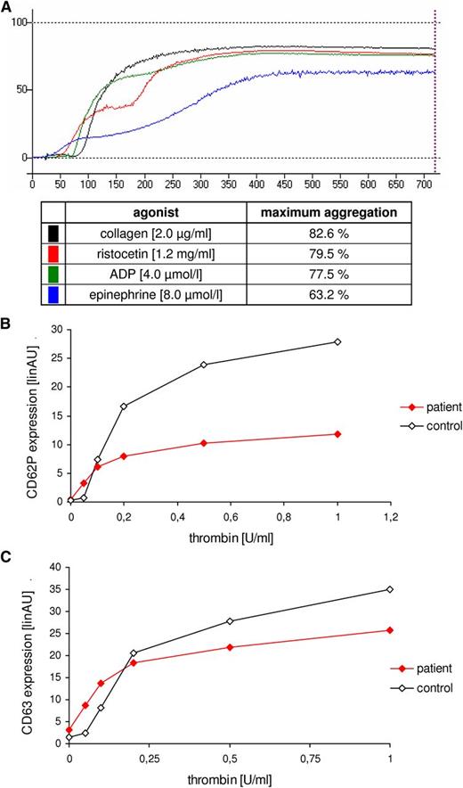 Figure 1. Platelet function analyses. (A) Platelet aggregation/agglutination was stimulated with collagen (2.0 µg/mL), ristocetin (1.2 mg/mL), adenosine 5'-diphosphate (4.0 µmol/L), and epinephrine (8.0 µmol/L). Analysis was performed with an aggregometer (APACT; Labor Fibrintimer). (B-C) Flow cytometric quantification of platelet granule secretion was stimulated using increasing concentrations of thrombin (0, 0.05, 0.1, 0.2, 0.5, and 1.0 U/mL). After fixation cells were washed and incubated with fluorescein isothiocyanate-conjugated anti-CD62 (B) or fluorescein isothiocyanate-conjugated anti-CD63 (C). Surface fluorescence was analyzed with a flow cytometer (FACS Calibur; Becton Dickinson). Analyses were performed with patient’s platelets and platelets from a healthy control.