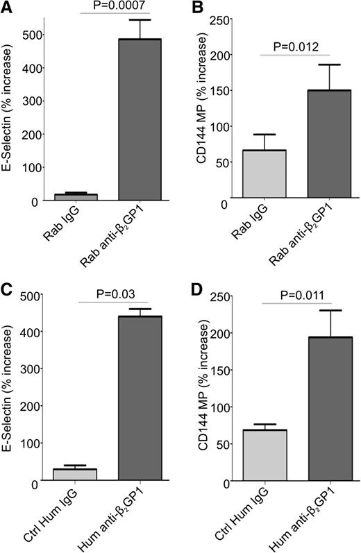 Figure 1. Anti-β2GP1 antibodies induce cell surface E-selectin expression and the release of endothelial cell microparticles. Endothelial cells were activated by incubation with 100 nM β2GP1 and 600 nM affinity-purified rabbit (A-B) or human (C-D) anti-β2GPI antibodies for 8 hours. Human IgG anti-β2GPI antibodies used in this experiment were affinity purified from a patient with a history or recurrent deep vein thrombosis who had an anti-β2GPI antibody level of 60 SGU and a lupus anticoagulant. Results obtained using anti-β2GPI IgG from this patient are representative of 2 additional patients that were also studied. Endothelial cell surface E-selectin (A,C) was measured as described in “Materials and methods.” Endothelial microparticles were measured in conditioned medium using flow cytometry after staining with anti-CD144 antibodies (B,D). For consistency, data are presented as the percent increase in E-selectin expression or microparticle release caused by control or anti-β2GPI IgG relative to that by cells incubated in medium alone. All values were determined in quadruplicate, and all assays repeated at least 3 times. Differences between control and experimental conditions were assessed using the Student 2-tailed t test. Ctrl, control; Hum, human; Rab, rabbit.