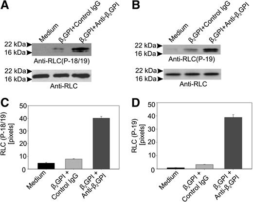 Figure 3. Anti-β2GPI antibodies stimulate phosphorylation of myosin RLC. (A) Phosphorylation of RLC residues T18 and S19 in response to anti-β2GPI antibodies. Total lysates prepared from endothelial cells incubated with β2GPI and anti-β2GPI antibodies for 60 minutes were subjected to immunoblotting using an anti–phospho-RLC (T18/S19) antibody. After blotting with the phosphorylation-specific antibody, blots were stripped and reblotted with an antibody to RLC. (B) The same lysates depicted in panel A were immunoblotted using an antibody specific for phosphorylated S19 in RLC. (C) Densitometric analysis of panel A using NIH ImageJ. (D) Densitometric analysis of panel B using NIH ImageJ.