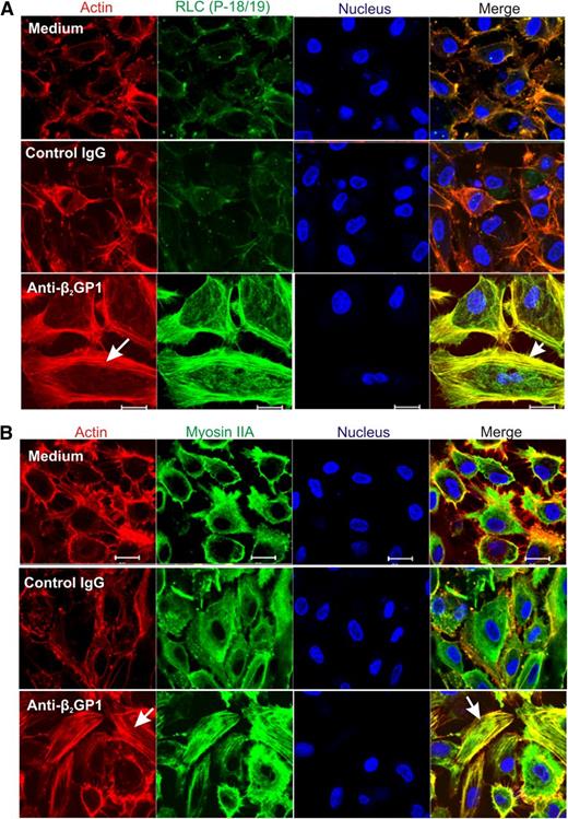 Figure 4. Immunolocalization of phosphorylated RLC and myosin IIA in anti-β2GPI antibody-exposed endothelial cells. Endothelial cells were incubated with medium alone, or with β2GPI and either control or anti-β2GPI antibodies, and then fixed and stained with RLC (P-18/19) or myosin IIA antibodies. Cells were also stained with phalloidin to study formation of the actin network, and with 4,6 diamidino-2-phenylindole to localize nuclei. (A) Assembly of the actin network (arrow, lower left panel) occurs exclusively in cells treated with β2GPI and anti-β2GPI antibodies, with colocalization of phosphorylated RLC and actin (arrow, lower right panel). (B) Incubation of cells with anti-β2GPI antibodies causes actin assembly (arrow, lower left panel), as well as actin-myosin association, as demonstrated by colocalization of these 2 proteins (arrow, lower right panel). Confocal images were collected using a ×63 oil objective with 1.4 numerical aperture on a Zeiss LSM 501 microscope. Bar represents 20 μm.