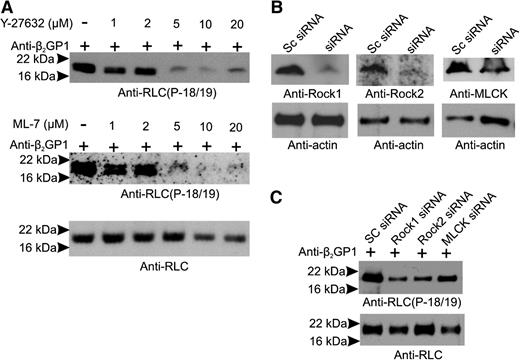 Figure 5. RLC phosphorylation in response to anti-β2GPI antibodies is prevented by MLCK or ROCK inhibition. Endothelial cells were incubated with β2GPI and anti-β2GPI antibodies in the absence or presence of increasing concentrations of the MLCK inhibitor ML-7 or the ROCK inhibitor Y-27632. (A) Lysates were immunoblotted with anti-phosphoRLC (T18/S19) (upper and middle panels) or anti-RLC (total protein). (B) Endothelial cells were treated with scrambled (Sc) RNA (control) or siRNA specific for ROCK-1, ROCK-2, or MLCK; blotting with anti-actin antibodies was used to demonstrate equal loading. (C) Effect of siRNA knockdown of ROCK-1, ROCK-2, or MLCK on levels of phosphorylated RLC. Significant inhibition was caused by knockdown of each of the kinases.