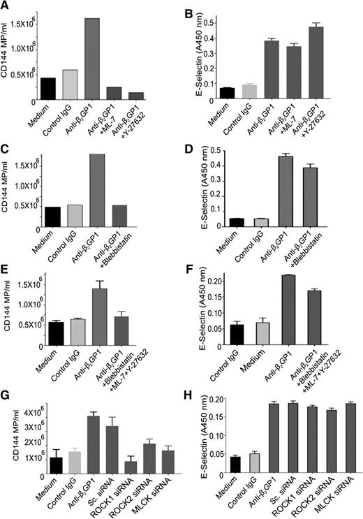Figure 6. Effect of inhibiting RLC phosphorylation stimulated by anti-β2GPI antibodies on endothelial microparticle release and cell surface E-selectin expression. Endothelial cells were incubated in medium alone or with β2GPI and control or anti-β2GPI antibodies for 8 hours and the release of microparticles and cell surface expression of E-selectin quantified as described in “Materials and methods.” Inhibitors used include Y-27632 (5 µM), ML-7 (5 µM), or blebbistatin (50 µM). Inhibitors were used alone or in combination, as depicted in abscissa of each graph. (A,C,E,G) The effects of inhibitors or specific siRNA on endothelial cell microparticle release induced by anti-β2GPI antibodies. (B,D,F,H) The effects of inhibitors or specific siRNA on endothelial E-selectin expression induced by anti-β2GPI antibodies.