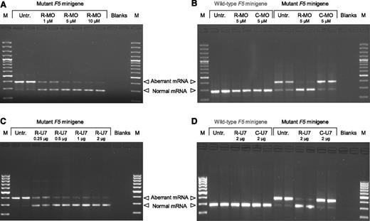 Figure 2. Splicing correction in COS-1 cells. (A-B) COS-1 cells were transfected with the mutant or wild-type F5 minigene construct and either left untreated or treated with the indicated concentrations of rescuer MO or control MO. (C-D) COS-1 cells were transfected with the mutant or wild-type F5 minigene construct and either left untreated or cotransfected with the indicated amounts of the U7-SmOPT construct expressing anti-F5 (rescuer) U7snRNA or control U7snRNA. The 2-μg U7-SmOPT construct corresponds to a molar excess of 4.8× over the F5 minigene construct. After 48 hours, RNA was isolated, reverse-transcribed, and analyzed by PCR and gel electrophoresis. Representative gels are shown. M, 100-bp marker; Untr., untreated; R-MO, rescuer MO; C-MO, control MO; R-U7, rescuer U7snRNA; C-U7, control U7snRNA.