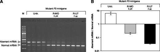 Figure 3. Splicing correction in HepG2 cells. HepG2 cells were transfected with the mutant F5 minigene construct and either left untreated or treated with 5 μM rescuer MO or cotransfected with 2 μg of the U7-SmOPT construct expressing anti-F5 (rescuer) U7snRNA. The 2-μg U7-SmOPT construct corresponds to a molar excess of 4.8× over the F5 minigene construct. After 48 hours RNA was isolated, reverse-transcribed and analyzed by PCR and gel electrophoresis (A) and real-time qPCR (B). The gel shows the effects of 5 μM R-MO and 2 μg of rescuer U7snRNA construct on F5 pre-mRNA splicing in HepG2 cells transfected with the mutant F5 minigene (quadruplicate transfections). Results of the quantification experiments are expressed as the ratio between the aberrant and normal F5 mRNA, plotted on a logarithmic scale. The quantification data represent the mean ± SD of the 4 replicates. M, 100-bp marker; Untr., untreated; R-MO, rescuer MO; R-U7, rescuer U7snRNA.