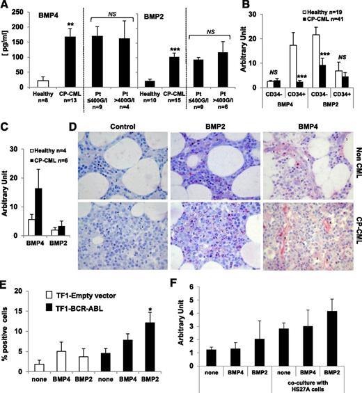 Figure 3. High levels of BMP2 and BMP4 produced by the CML microenvironment contributes to BMPRIb-induced expression. (A) Enzyme-linked immunosorbent assay quantification of BMP4 and BMP2 in BM plasma obtained from healthy donors and CP-CML samples at diagnosis. Data are categorized according to circulating platelet number measured for CML patients as either normal (≤400 G/L) or abnormally elevated (>400 G/L). Results expressed in picograms per milliliter represent the mean value ± SEM of the indicated number of analyzed samples. *P < .005 and ***P < .0001 indicate differences between the levels of BMP2 and BMP4 in CP-CML samples at diagnosis compared with healthy samples. Comparative expression of BMP2 and BMP4 genes in (B) CD34+ and CD34− cells obtained from healthy (n = 19; open bars) and CML (n = 41; closed bars) blood samples, *P < .0001 indicates differences between the expression of BMP2 and BMP4 genes in CML patient blood samples in CP at diagnosis compared with healthy samples and in (C) stromal cells derived from 3–4 weeks of culture of unmanipulated BM samples from healthy (n = 4; open bars) and at diagnosis CP-CML (n = 6; closed bars) samples. (D) In situ staining of BMP2 and BMP4 and their control antibody performed on sections of BM biopsies from nonhematologic malignancy patients (n = 2; upper panels) and CP-CML patients at diagnosis (n = 3; lower panels). Pictures were captured on a DMR microscope using PL Fluotar objective (Leica) at a magnification of ×40/1.00–0.50 oil. The following cells are indicated in the picture: (1) polynuclear neutrophils, (2) immature granular neutrophils (promyelocytes/myelocytes), (3) megakaryocytes, (4) erythroblasts, and (5) endothelial cells of the sinusoid. (E) Flow cytometry analysis of BMPRIb receptor cell surface expression on parental TF1 cells either transduced with an empty vector (non–BCR-ABL; open bars) or transduced with a vector containing BCR-ABL expressing sequence (closed bars) after chronic exposure for 4 weeks to either BMP2 or BMP4 (50 ng/mL). Results represent the mean value ± SEM of 8 experiments. *P < .05 indicates differences between parental TF1 cells transduced with an empty vector and BCR-ABL–transduced TF1 cells. (F) Selected CD34+ cells isolated from CP-CML samples were incubated in serum-free medium (6 × 105/mL) for 7 days in the presence of BMP4 or BMP2 (50 ng/mL), with or without coculture on a stroma composed of HS27A cells seeded at 2 × 104 cells/mL 1 day before the experiment. Comparative expression of the BMPRIb gene was then performed on CP-CML CD34+cells. Results represent the mean value ± SEM of 3 experiments.