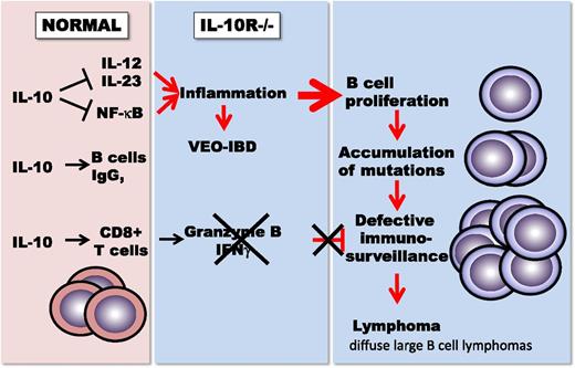 IL-10 balances proinflammatory immune regulation against the stimulation of CD8+ T-cell–mediated immunity and immunoglobulin G (IgG) production in B cells. In the absence of IL-10 receptors, patients with very-early-onset IBD suffer from severe childhood colitis. The absence of CD8+ T-cell–mediated immunosurveillance leads to the development of diffuse large B cell lymphomas.
