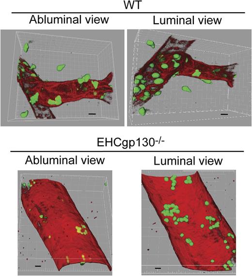 Three-dimensional reconstructions of confocal microscopy images of TNF-α–activated venules of cremaster microcirculation from WT (top) and EHCgp130–/– mice (bottom). Adherent neutrophils are shown in green. Note that in venules of WT mice, the luminal side has many adherent neutrophils and the basolateral side contains several neutrophils that have exited the vessel. Most neutrophils have migrated into the interstitial space well beyond the vessel. In contrast, the venules of the EHCgp130−/− mice contains neutrophils adherent to the luminal surface but very few neutrophils that have exited the vessel. See Figure 5E in the article by Yao et al, which begins on page 3832.