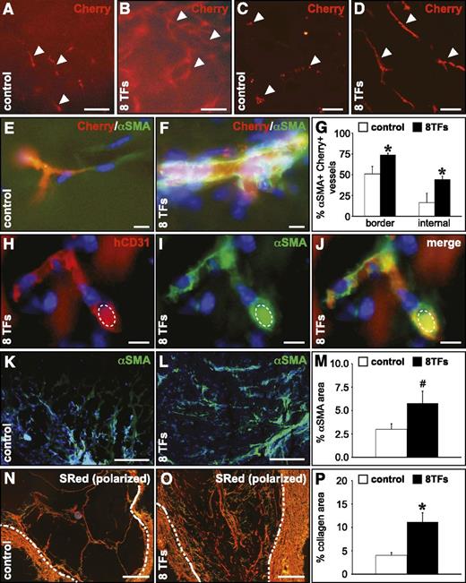 Figure 6. Overexpression of the 8 TFs in HUVECs conveys an arterial-like behavior upon their implantation in a Matrigel plug in vivo. Overexpression of the 8 TFs in HUVECs results in a more significant arteriogenic capacity in a subcutaneous Matrigel implant. (A-D) Fluorescent micrographs of Matrigel implants containing HUVECs (revealed by the Cherry signal in red; indicated by white arrowheads) transduced with a control vector (A,C) or with the combination of the 8 TFs (B,D). Panels A-B represent the ex vivo nonsectioned Matrigel explant, and panels C-D represent frozen cross sections. (E-G) Frozen cross sections from Matrigels containing control HUVECs (E; white bars in G) or HUVECs transduced with the 8 TFs (F; black bars in G) stained with αSMA (green), and the corresponding quantification (G) showing the percentage of HUVEC-containing (revealed by the Cherry signal) vessels coated with αSMA+ cells (*P < .05 vs control). (H-J) Cross section from a Matrigel containing HUVECs transduced with 8 TFs stained with human-specific CD31 (red) and αSMA (green) and the corresponding overlay (J). An autofluorescent erythrocyte is indicated by a dashed ellipse. (K-M) Cross sections from a Matrigel containing control HUVECs (K; white bar in M) or HUVECs transduced with 8 TFs (L; black bar in M) stained with αSMA (green) and the corresponding quantification (M), showing the relative αSMA+ area (#P = .08 vs control). (N-P) Cross sections from a Matrigel containing control HUVECs (N; white bar in P) or HUVECs transduced with 8 TFs (O; black bar in P) stained with Sirius red (visualized under polarized light) and the corresponding quantification (P), showing the relative Sirius red–positive area (*P < .05 vs control). Dashed white lines indicate the inner edge of the fibrous Matrigel capsule. 4,6 Diamidino-2-phenylindole (blue) is used as nuclear counterstain in panels E, F, and H-L. Scale bars: 100 μm in A-D, 10 μm in E-F and H-J, and 200 μm in K-L and N-O.