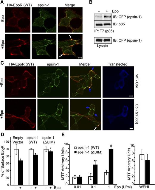 Figure 5. Epo induces EpoR co-localization with epsin-1. (A) Endogenous epsin-1 becomes co-localized with wild-type EpoR upon Epo stimulation. Nonpermeabilized γ2A/HA-EpoR/JAK2 cells were stained with anti-HA antibodies to label the exofacial HA-tag of the EpoR as described previously.5 Cell were then treated with Epo for 12 minutes, fixed, permeabilized, immunostained for epsin-1, and visualized by confocal microscopy. The scale bar represents 5 μm. Representative co-localization areas are marked with arrows. (B) Epo induces p85 binding to epsin-1. ECFP-tagged epsin-1 and T7-tagged p85 were transiently expressed in γ2A/HA-EpoR/JAK2. Anti-T7 immunoprecipitates were immunoblotted with anti-GFP antibody to detect epsin-1. (C) EpoR-epsin-1 co-localization is impaired in cells expressing a ligase-deficient Cbl mutant. γ2A/HA-EpoR/JAK2 cells were transfected with either wild-type myc-tagged Cbl or Cbl(ΔY368). Forty-eight hours after transfection, cells were stained as described before, except Alexa 488 anti-myc antibody was used to mark transfected cells. The blue arrows indicate the transfected cells, and the white arrow shows co-localization in an untransfected cell. (D) Expression of epsin-1(ΔUIM) impaired EpoR internalization. Epo-induced EpoR internalization was determined by flow cytometry in γ2A cells co-transfected with vectors expressing HA-EpoR, JAK2, and ECFP-tagged epsin-1 (either wild-type or the ΔUIM mutant). Data were normalized to EpoR surface expression of unstimulated control cells. *P < .05 between epsin-1(WT) and epsin-1(ΔUIM). (E) BaF3 cells expressing HA-EpoR and epsin-1 (either wild-type or the ΔUIM mutant) were grown in RPMI media containing 2% fetal bovine serum (FBS) with different concentrations of Epo. Cell growth was measured using MTT assays. Cells grew similarly in WEHI media and 10% FBS. Epsin-1(ΔUIM)–expressing cells exhibit Epo hypersensitivity. **P < .005.