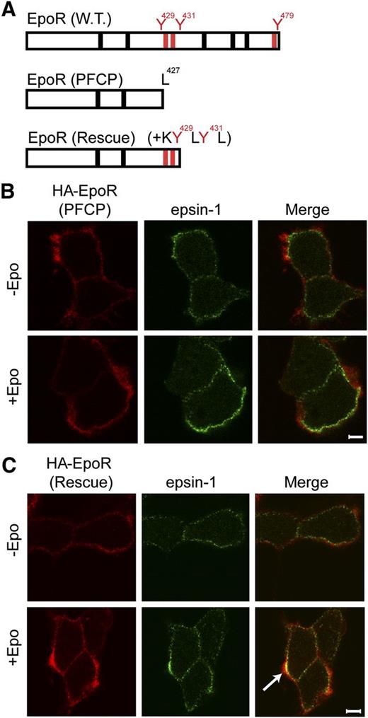 Figure 6. Appendage of p85-binding sites restores Epo-induced epsin-1 co-localization of a truncated EpoR that mimics those from PFCP patients in γ2A cells. (A) Schematic diagram of PFCP and rescue EpoR constructs. (B) PFCP EpoR did not co-localize with epsin-1 upon Epo stimulation. (C) Rescue EpoR appended with p85-binding sites rescued Epo-induced epsin-1 co-localization. The arrow points to a representative co-localization area.