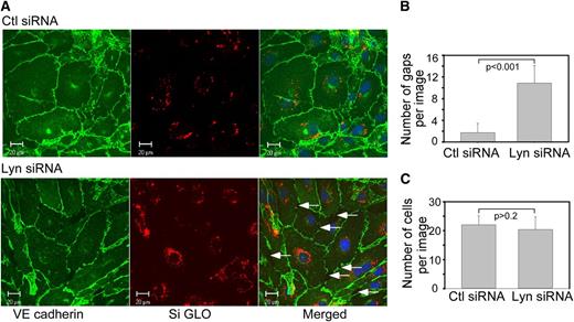 Figure 4. Down-regulation of Lyn kinase in confluent endothelial cells disrupts AJ. (A) HUVECs were transfected with control or Lyn siRNA together with DY-547–labeled siGLO RISC-free control siRNA to allow visualization of siRNA transfected cells. Forty-eight hours after transfection, cells were fixed and immunostained for VE-cadherin. In control siRNA transfected HUVECs, VE-cadherin staining was continuous along cell borders indicative of its presence at the AJs. In Lyn siRNA-transfected cells, VE-cadherin was lost from AJs, resulting in formation of interendothelial gaps, as pointed by the arrows. (B) Quantification of gaps and (C) cell numbers in 4 random images (mean ± SD).