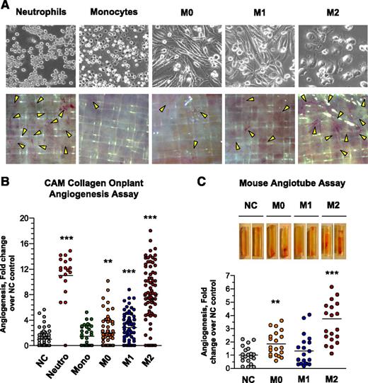 Figure 2. Comparative analysis of angiogenic capabilities of human neutrophils, monocytes, and mature and polarized macrophages. (A) Angiogenic potential of intact leukocytes in the in vivo CAM angiogenesis model. (Upper) Freshly purified neutrophils and monocytes, and macrophages of M0, M1, and M2 phenotypes were incorporated into 2-tier gridded 3D collagen onplants (3 × 104cells/onplant), which were grafted on the CAM of chick embryos. Images were acquired using an Olympus CKX-41 microscope equipped with Olympus U-LS30-3 video camera and Infinity Capture software and processed using Adobe Photoshop. Objective lens, ×20. (Lower) After 76 hours of incubation, the onplants were scored for the presence of newly developed angiogenic vessels distinctly localized above the plane of the lower mesh grids (yellow arrowheads). Images were acquired using an Olympus binocular microscope SZ-PT (Olympus America, Melville, NY) equipped with a DVC video camera and high-performance ImageJ plugin acquisition software. Objective lens, 10×. (B) Angiogenesis-inducing capability of intact cells. The levels of angiogenesis were quantified for individual onplants as a ratio of grids containing new blood vessels to total number of scored grids, providing an angiogenic index. From 4 to 6 embryos, each grafted with 6 collagen onplants, were analyzed in 3 independent experiments. Scattergram presents fold changes in the levels of angiogenesis compared with negative no-cell (NC) control (1.0). Lines represent means of fold changes in angiogenic indices. **P < .01; ***P < .0001. (C) Comparative analysis of mature and polarized macrophages in the mouse angiotube model. Intact viable M0, M1, and M2 macrophages were incorporated into 2.5 mg/mL native collagen at 2 × 106 cells/mL. Phosphate-buffered saline (PBS) was used as a negative, no-cell control (NC). Collagen mixtures were polymerized in the ∼1-cm-long tubes (angiotubes), which were surgically implanted under the skin of immunodeficient mice. The angiotubes were excised from the mice 12 to 14 days after implantation (images on the top). The contents of angiotubes were lysed in equal volumes of lysing buffer and hemoglobin concentration was determined, providing measurements of angiogenesis-inducing capacity of tested cells. Scattergram presents fold changes in the levels of angiogenesis induced by different macrophage types compared with negative NC control (1.0). Lines represent means of fold changes. Shown is a representative experiment from 2 independent experiments, each using from 4 to 5 mice, each implanted with 4 angiotubes. **P < .01; ***P < .0001, between the means from the experimental groups vs NC control.